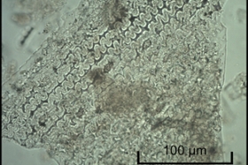Foto: Mehrzelliger Getreide-Phytolith aus Göbekli Tepe (Türkei)